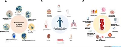 Alternative in-vivo models of mucormycosis